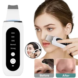 I-Ultrasonic Skin Scrubber Icwecwa I-Blackhead Remover I-Deep Face Cleaning I-Ultrasonic Ion Ance I-Pore Cleaner Facial Shovel Device