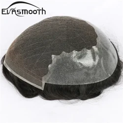 Q6 Parpailak Toupee Gizonak Europa Giza ilea Gizonezko ileordea Suitzako Parpailaren aurrealdeko ileordea Pu Gizonezkoen ilea ordezkatzeko sistema Unitatea Gizonezko ileordea Ile naturala