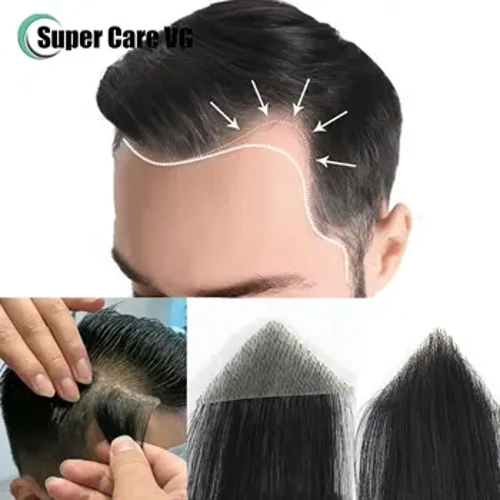 Con Người Tự Nhiên Tóc Miếng Tóc Giả Nam Trán Bộ Tóc Giả Miếng Dán Vô Hình Liền Mạch Da Siêu Mỏng PU Nam Mao Mạch Chân Giả