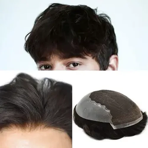 Gizonezkoen ile-sistema Suitzako parpailak Toupee Gizonentzako ile-pieza Europako giza ilearen ordezko sistema Korapilo zurituak Ile-lerro naturala