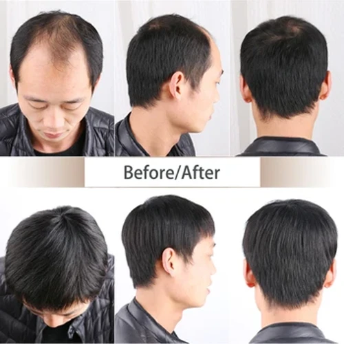 makatotohanang topper 100% buhok ng tao toupee ng lalaki natural na itim na kulay magaan ang timbang kumportable sa loob net panglalaki ng buhok na topper