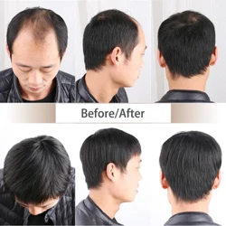 topper thực tế 100% tóc người tóc giả nam màu đen tự nhiên trọng lượng nhẹ lưới bên trong thoải mái topper tóc nam