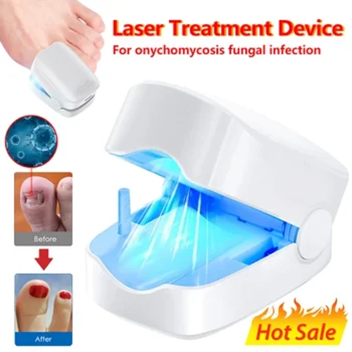 Dispositivo de tratamento a laser para fungos nas unhas, reparação de fungos nas unhas, tratamento de onicomicose, unhas a laser com cogumelos e relaxamento