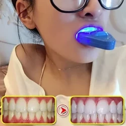 1pc Hortz Hortzak zuritzeko argia LED zuritzeko hortzak azeleragailua Hortzak zuritzeko kosmetika laserra Emakumeen edertasuna osasuna